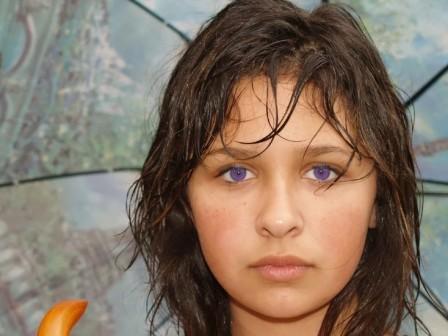 Александрийский синдром, редкий фиолетовый цвет глаз